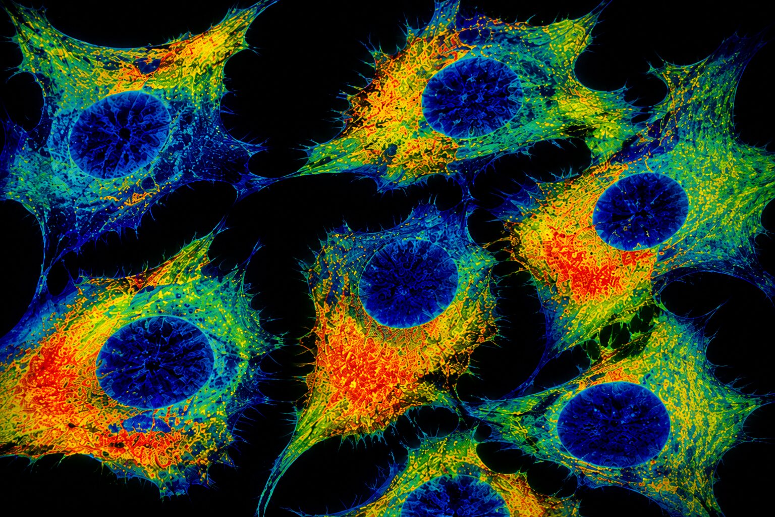 Boosting FLIM for Next-Generation Cancer Diagnostics